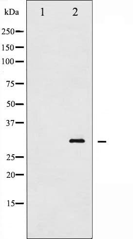 TNNI3 / Cardiac Troponin I Antibody (phospho-Thr142)