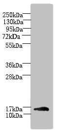 HSPC176 / TRAPPC2L Antibody