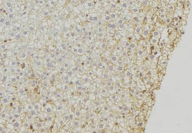 Polyclonal Rabbit anti-Human DNAJC15 Antibody (IHC, WB)