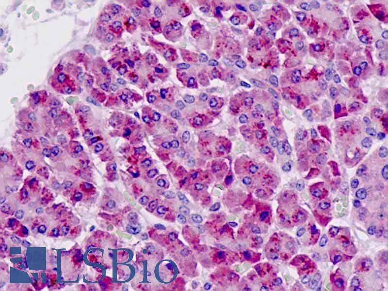 IHC-plus™ PAK6 Antibody (aa268-297)