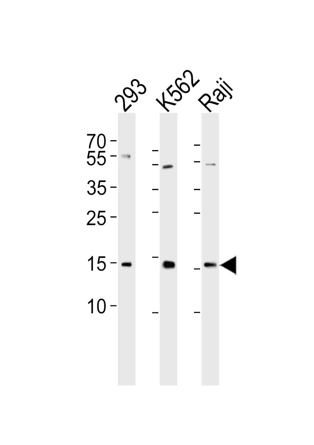 Polyclonal Rabbit anti-Human H2AFX / H2AX Antibody (Ser139, WB)