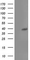 TBC1D21 Antibody (clone OTI1C7)