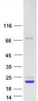 Human CDNF / ARMETL1 Protein (Recombinant Myc-DDK (Flag))