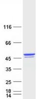 Human BROX Protein (Recombinant Myc-DDK (Flag))