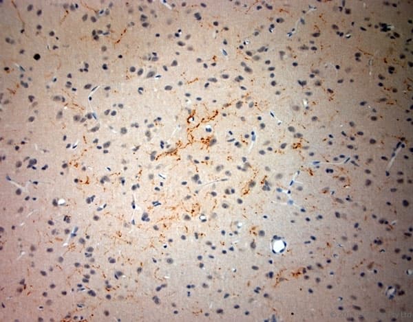 Polyclonal Rabbit anti-Rat SYNPO / Synaptopodin Antibody (aa890-930, IHC)