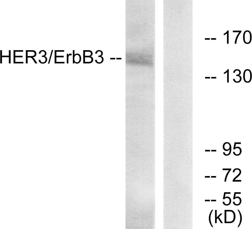 Polyclonal Rabbit anti-Human ERBB3 / HER3 Antibody (p1222, IHC, IF, WB)
