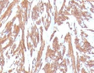 ACTA2 / Smooth Muscle Actin Antibody (clone SMAT2-1, Ready-to-Use)