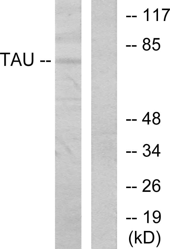 MAPT / Tau Antibody (aa491-540)