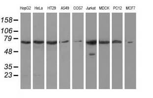 HAO1 Antibody (clone OTI3E7)