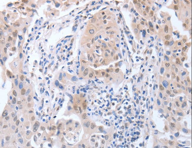Polyclonal Rabbit anti-Human APEX1 / APE1 Antibody (IHC, WB)