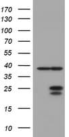 UBE2E3 Antibody (clone OTI2E5)