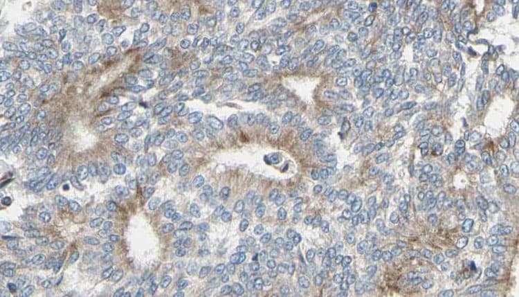 Polyclonal Rabbit anti-Human PKP4 / Plakophilin 4 Antibody (IHC, WB)