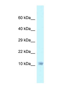 NDUFA6 Antibody (C-Terminus)