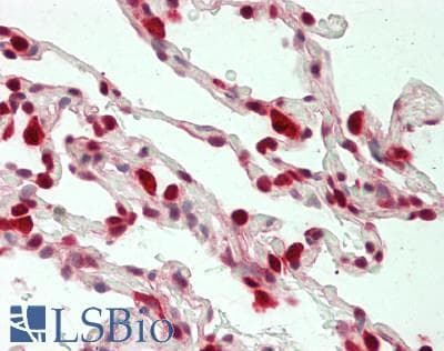 LTA4H / LTA4 Antibody (clone 8F4, Carrier-free)