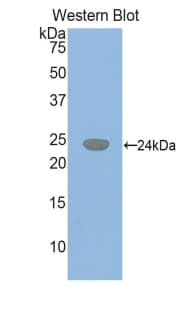 GSS / Glutathione Synthetase Antibody (aa270-474)