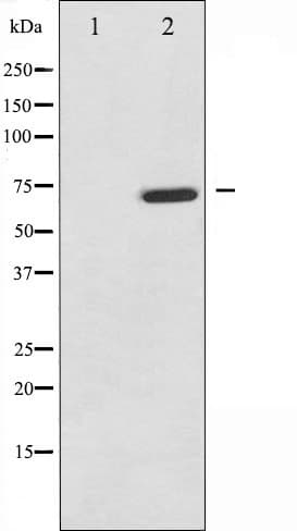 MAP3K7 / TAK1 Antibody (phospho-Thr187)