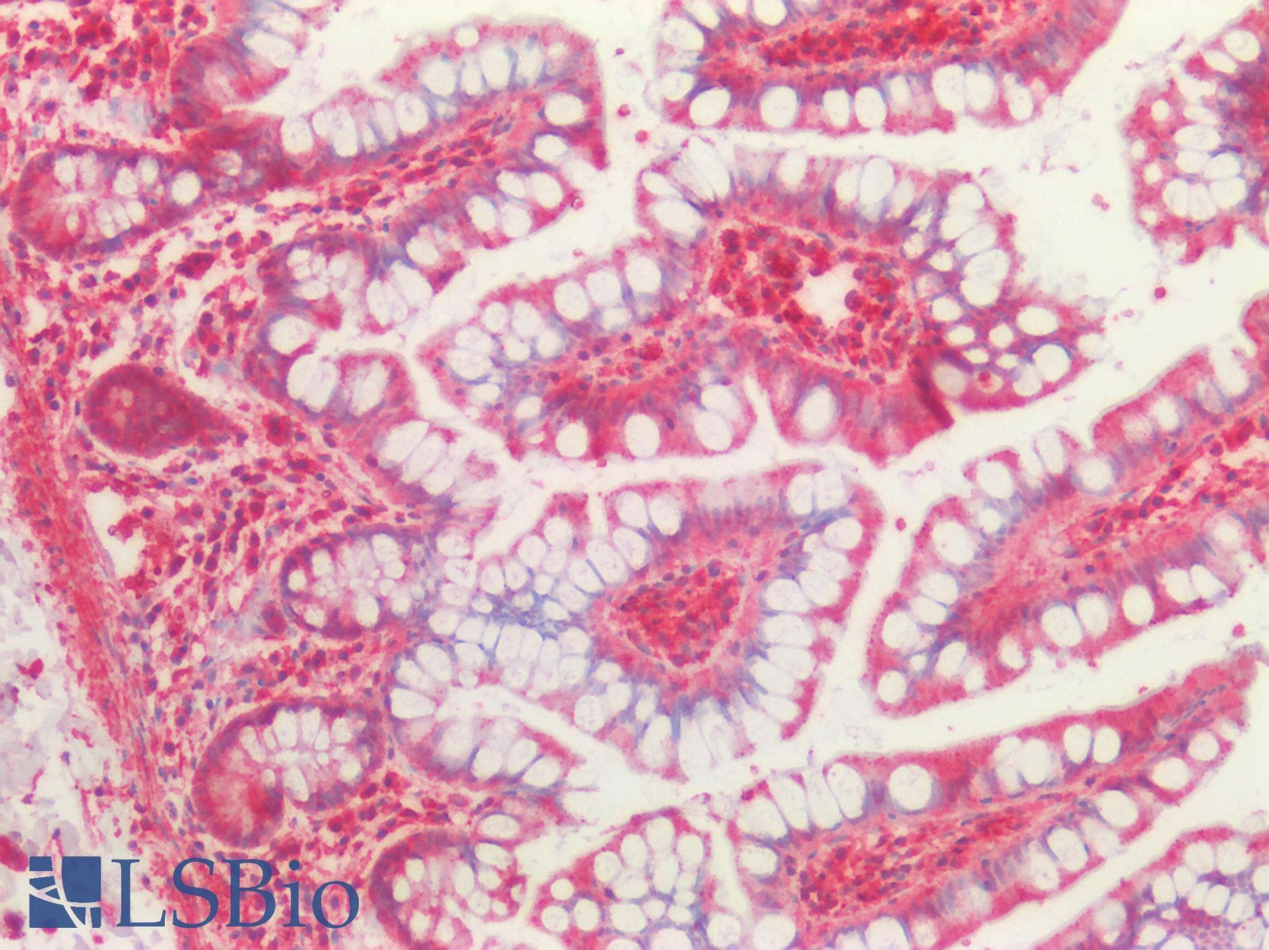 PathPlus™ TUBB / Beta Tubulin Antibody (aa174-428)