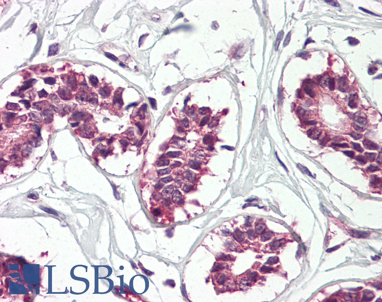 IHC-plus™ CRD-BP / ZBP1 / IGF2BP1 Antibody (aa19-32)
