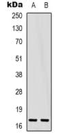 Polyclonal Rabbit anti-Human EIF5A2 Antibody (Internal, WB)