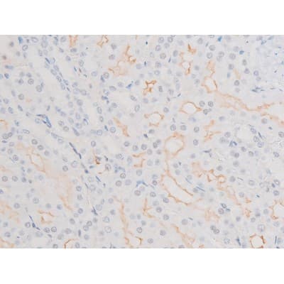 LIMK2 Antibody (phospho-Ser283)
