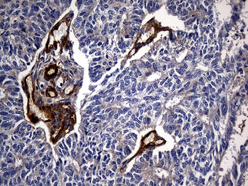 Monoclonal Mouse anti-Human CPM / Carboxypeptidase M Antibody (clone OTI4E11, aa124-423, IHC, WB)