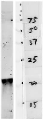 PathPlus™ Monoclonal Mouse anti-Human PARK7 / DJ-1 Antibody (clone 4H4, IHC, IF, WB)