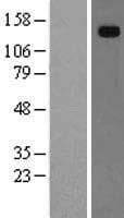 HEPH / Hephaestin Protein (Over-Expression Lysate Myc-DDK (Flag))
