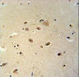 Polyclonal Rabbit anti-Human RRAGD Antibody (aa171-199, IHC, WB)