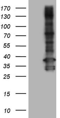 TACC2 Antibody (aa727-1026, clone OTI2D5)