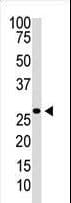 IHC-plus™ DKK2 Antibody (aa31-62)