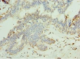 MAPK15 / ERK7 Antibody (aa1-95)