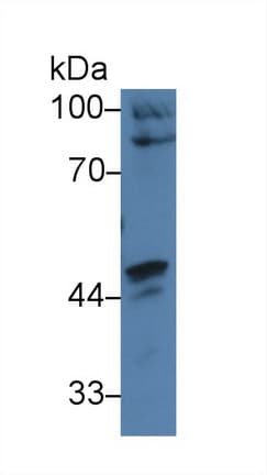 CARD9 Antibody (aa26-283, PE)