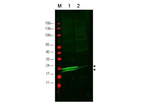 IHC-plus™ Polyclonal Rabbit anti-Human MLC2 / MYL9 Antibody (IHC, WB)