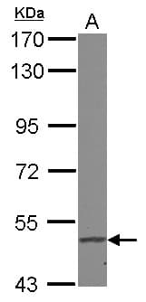 FADS1 Antibody