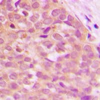 MAP3K8 / TPL2 Antibody (Internal)