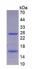 Human CEA / Carcinoembryonic Antigen Protein (Recombinant His, N-Terminal)