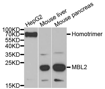 IHC-plus™ Polyclonal Rabbit anti-Human MBL2 / Mannose Binding Protein Antibody (IHC, WB)