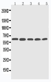 Polyclonal Rabbit anti-Human CYP2U1 Antibody (aa457-473, IHC, WB)