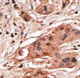 BCL2A1 Antibody (aa30-65)