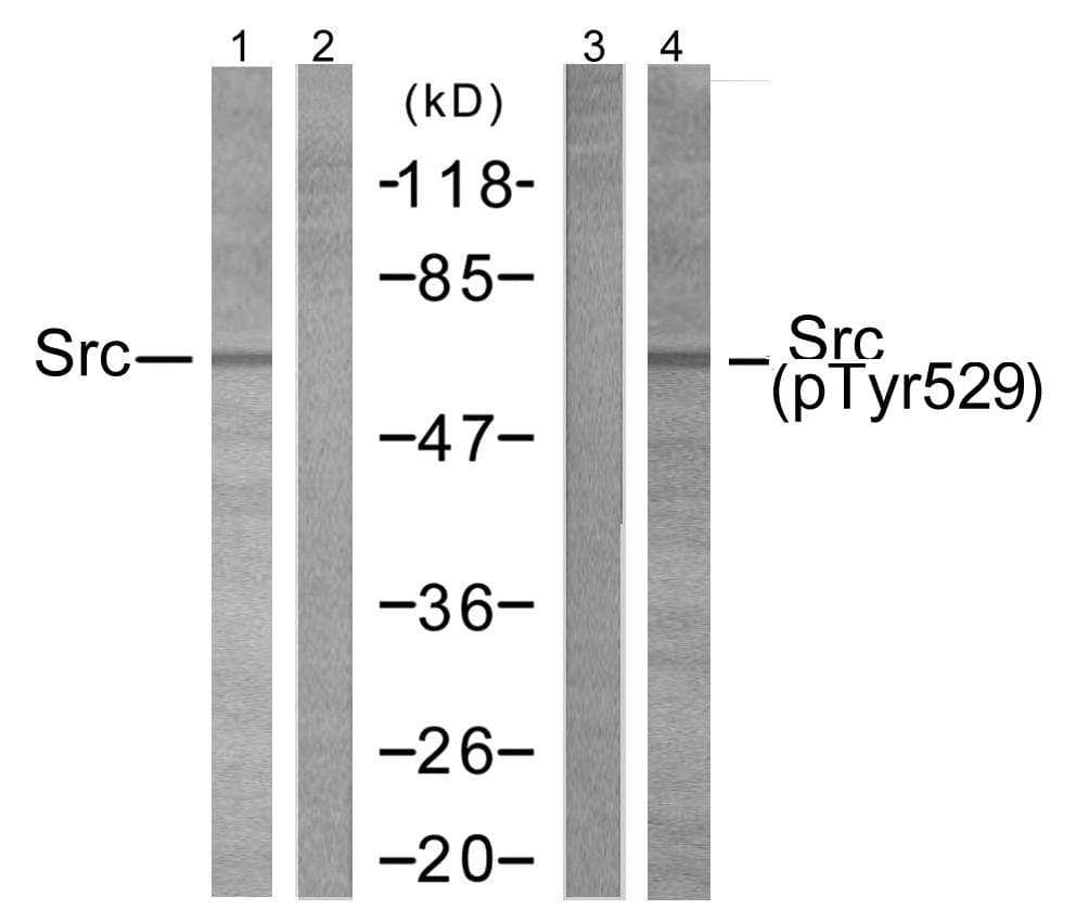 Polyclonal Rabbit anti-Human SRC Antibody (phospho-Tyr529, IHC, WB)