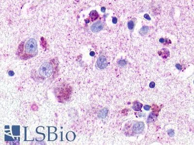 PathPlus™ Polyclonal Rabbit anti-Human NMUR1 Antibody (C-Terminus, IHC)