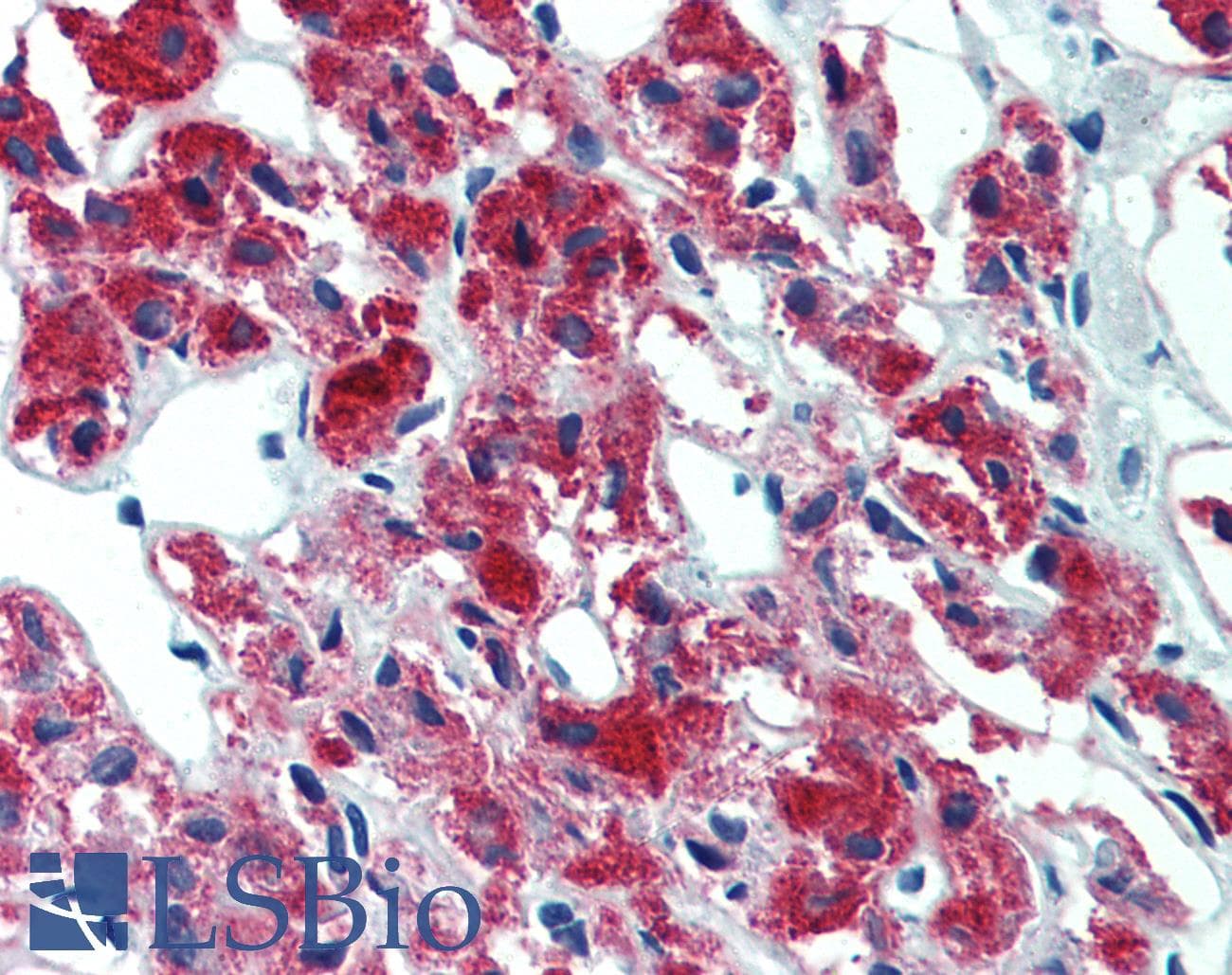 PathPlus™ IL23A / IL-23 p19 Antibody (clone HLT2736)