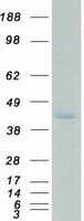 Human SSBP2 Protein (Recombinant Myc-DDK (Flag))