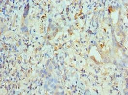 KIF2C / MCAK Antibody (aa1-190)