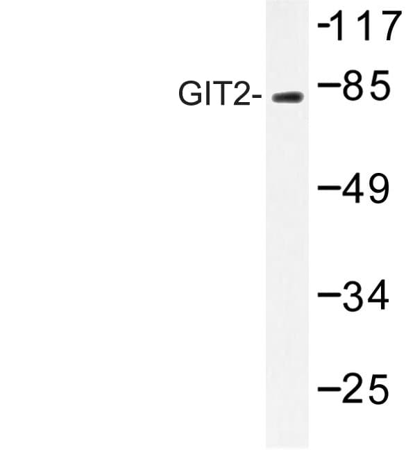 GIT2 Antibody (Asp391)