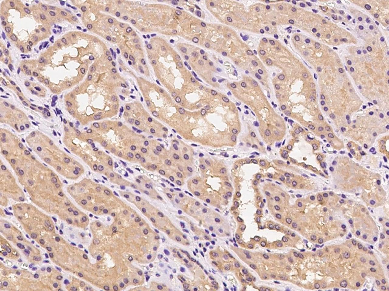 Polyclonal Rabbit anti-Human CYYR1 Antibody (IHC)