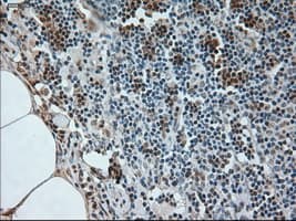 NEUROG1 / NGN1 / Neurogenin 1 Antibody (clone OTI3F9)