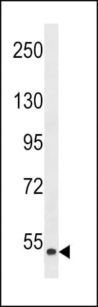 ZAK / MLTK Antibody (aa271-300)