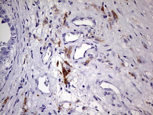 Polyclonal Rabbit anti-Human BAX Antibody (aa100-170, IHC, WB)