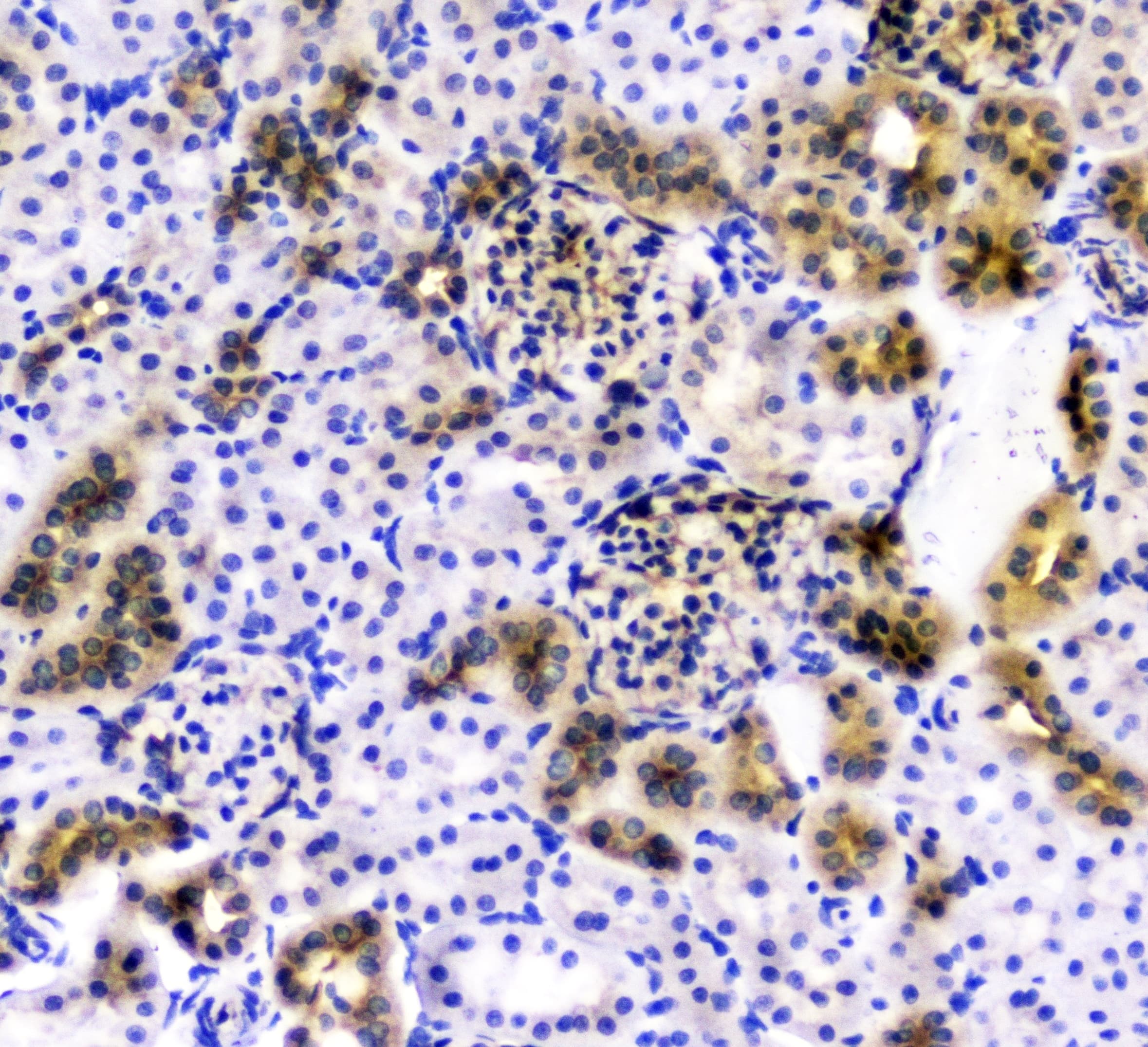 CD2AP Antibody